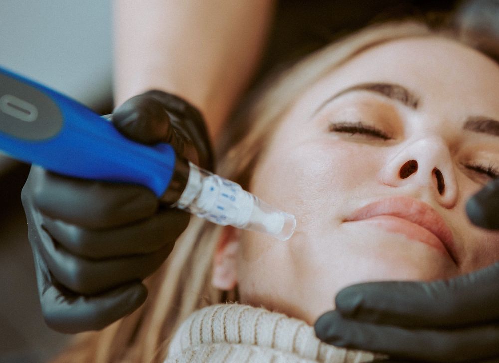 Microneedling