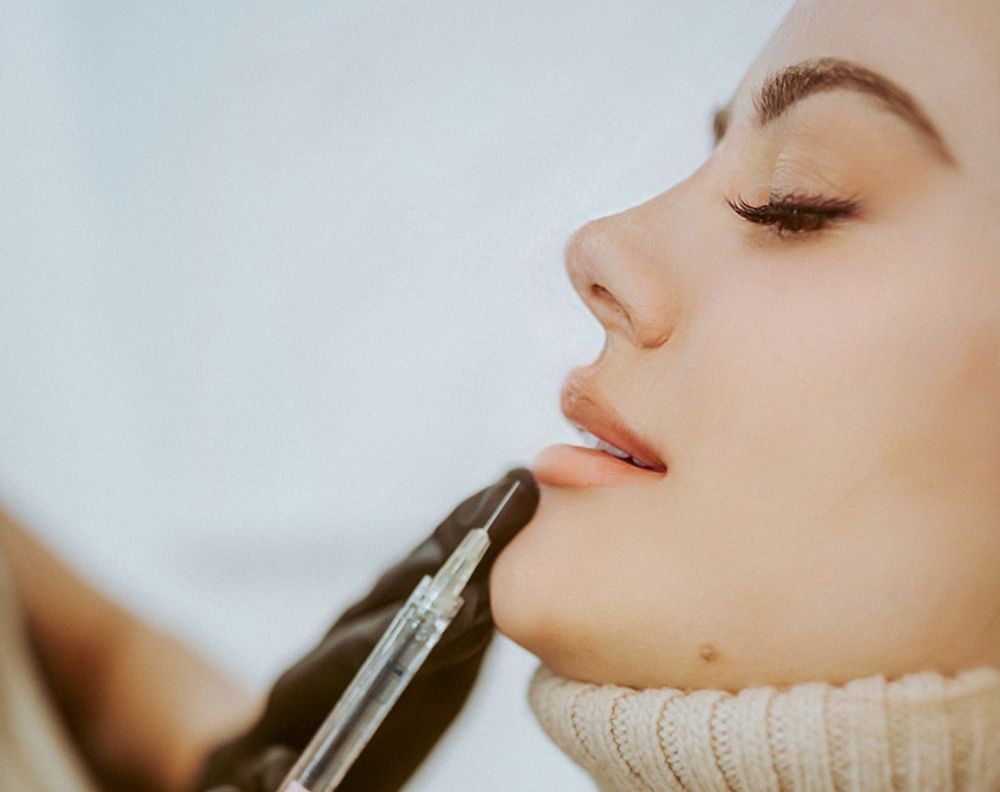 Dermal Fillers